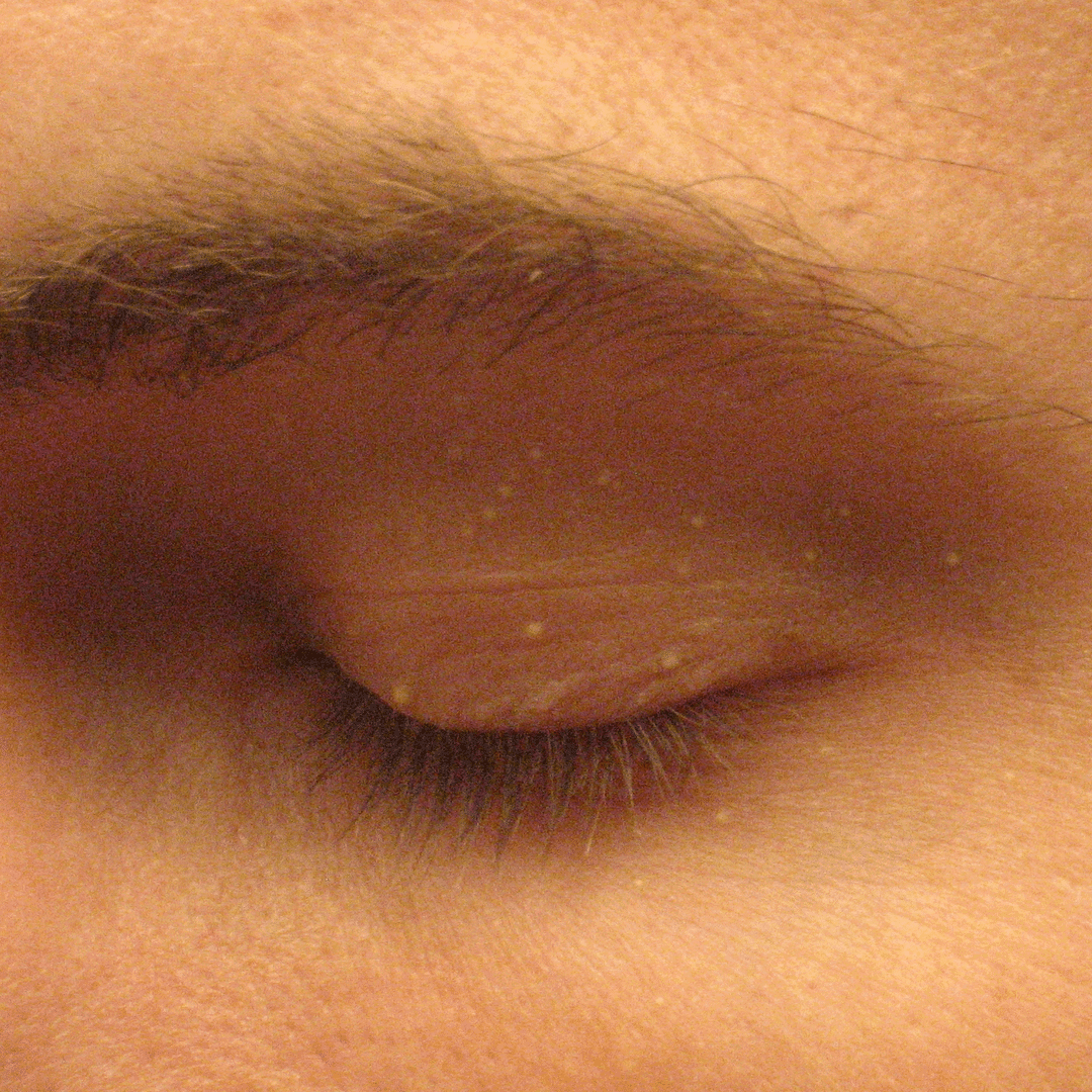 Face